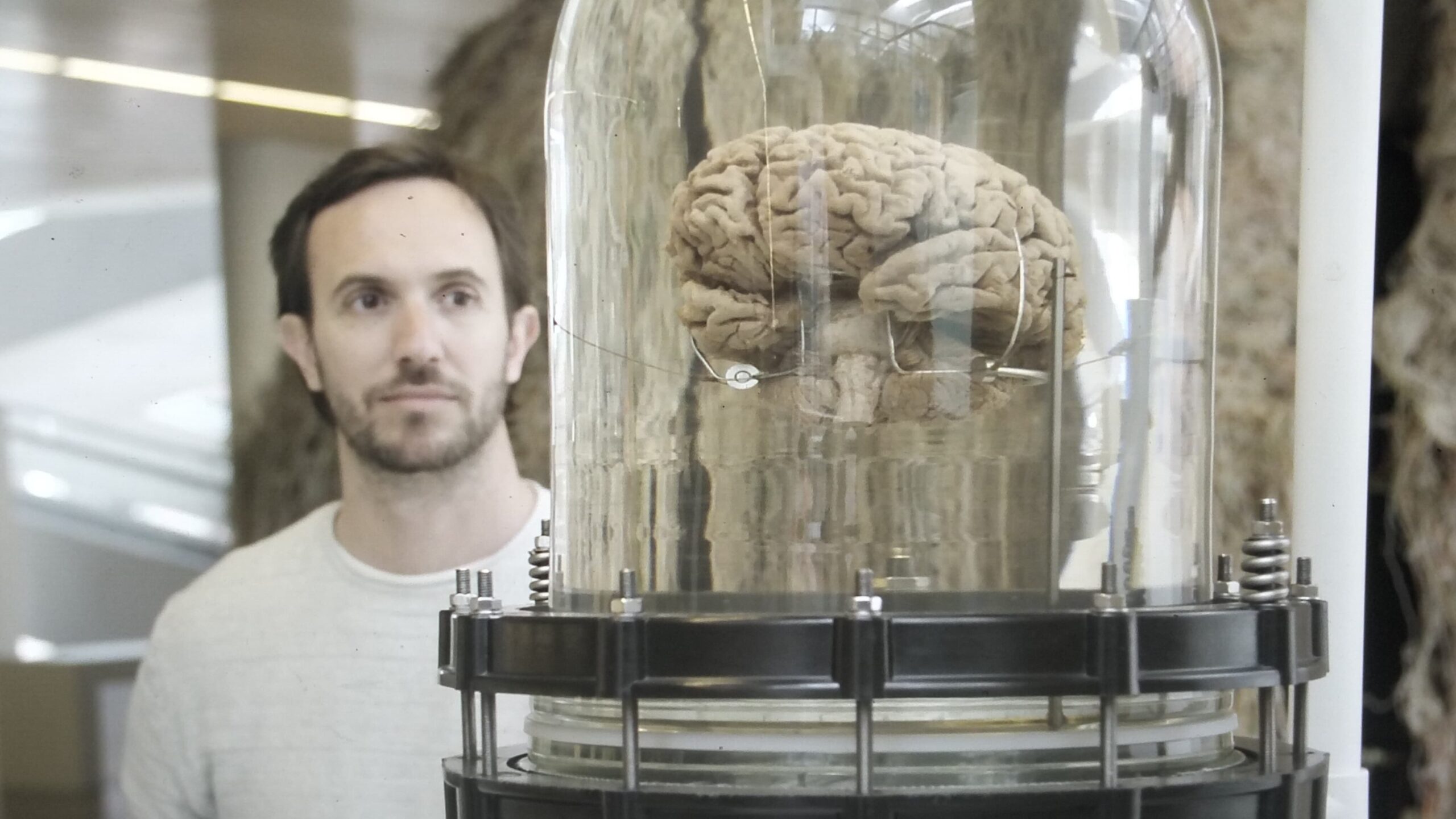 Representation of a brain connected with wires for stimulation, with the METATOOL coordinator in the background.