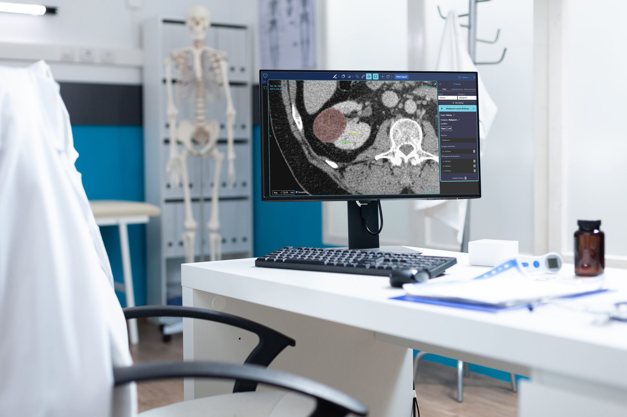 Picture of the technology (BM Vision Kidney) 3