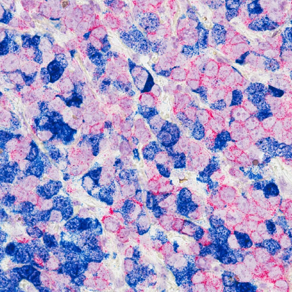 blue and pink stones