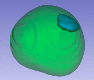 magnetic resonance imaging (MRI) image