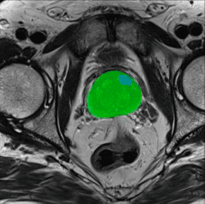 magnetic resonance imaging (MRI) image